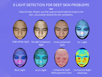 HD camera captures fine skin details, identifies 4 skin types, and analyzes moisture, pigmentation, wrinkles, pores, acne & UV damage.